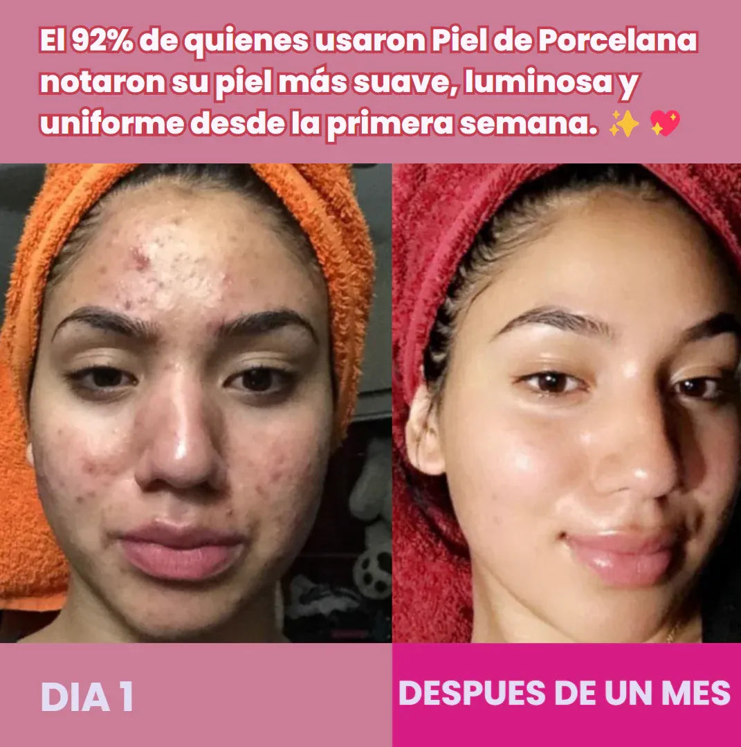 Piel de Porcelana
